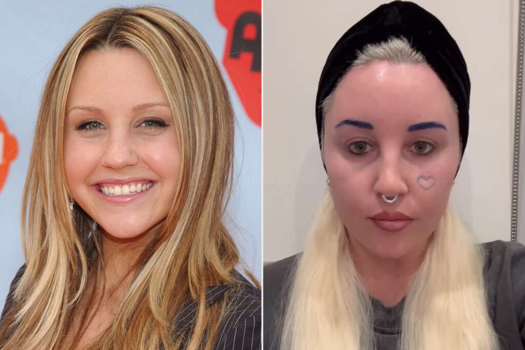 Amanda Bynes announced that she’s starting Ozempic to help her lose weight and improve how she looks in paparazzi photos. Photo: People