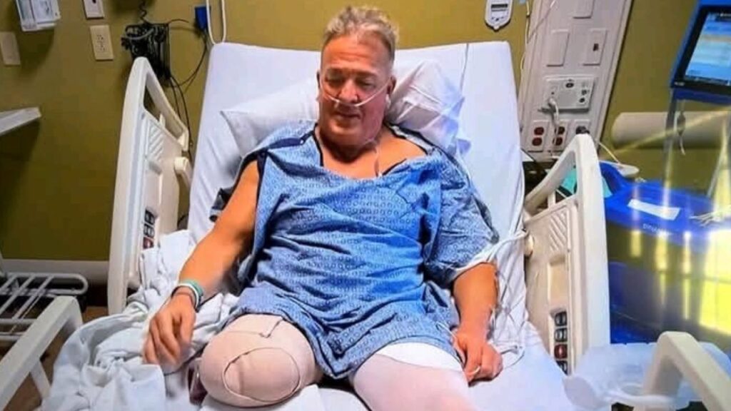 WCW legend Buff Bagwell has undergone a leg amputation following serious complications from a past car crash, stunning wrestling fans